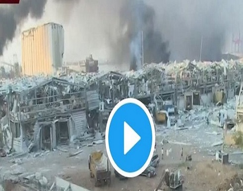 إصابة مواطنة أردنية بانفجار بيروت إصابة مواطنة أردنية بانفجار بيروت