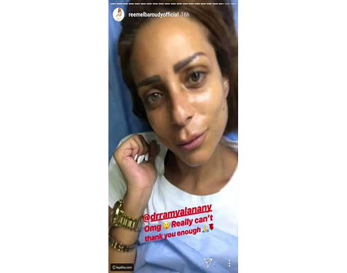 ريم البارودي تصدم الجميع بشكلها بعد إجرائها عملية تجميل ريم البارودي تصدم الجميع بشكلها بعد إجرائها عملية تجميل