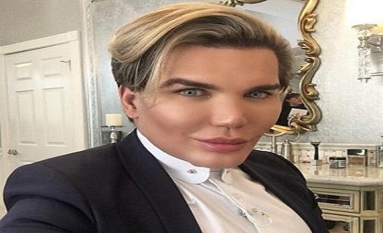 نتيجة كارثية لأحدث جراحة تجميلية للدمية كين نتيجة كارثية لأحدث جراحة تجميلية للدمية كين