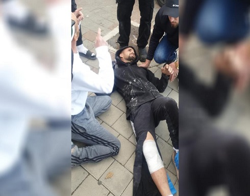 مستوطن يدهس شابين مقدسيين ويلوذ بالفرار مستوطن يدهس شابين مقدسيين ويلوذ بالفرار