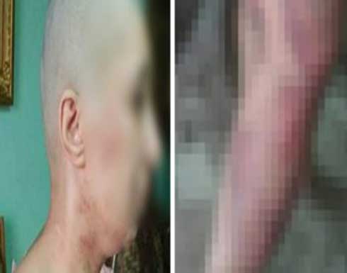 مصري يحلق شعر زوجته ويطفئ السجائر في جسدها .. تفاصيل مصري يحلق شعر زوجته ويطفئ السجائر في جسدها .. تفاصيل