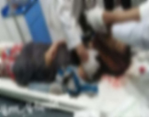 اليمن.. مقتل طفلة برصاص قناص حوثي غرب تعز اليمن.. مقتل طفلة برصاص قناص حوثي غرب تعز