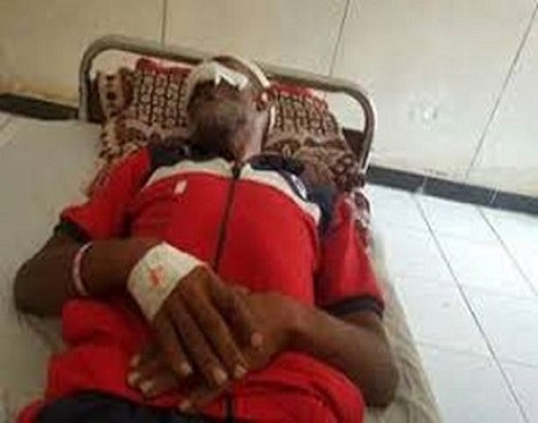 قطع أنف وشفاه .. معركة استمرت 8 ساعات بمصر قطع أنف وشفاه .. معركة استمرت 8 ساعات بمصر