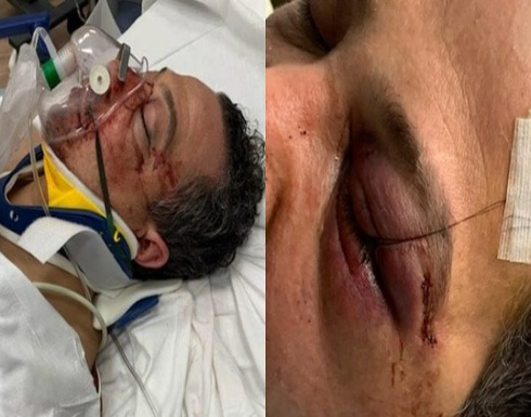 اعتقال امرأة شاركت في هجوم وحشي على عائلة عربية في نيويورك .. صور اعتقال امرأة شاركت في هجوم وحشي على عائلة عربية في نيويورك .. صور
