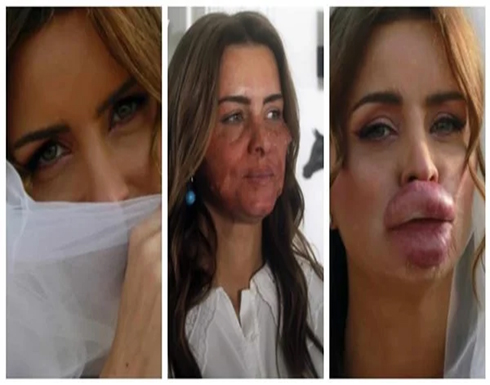 نور اللبنانية تظهر بتشوهات في وجهها بسبب فيلم "الدكتور نبيل أخصائي التجميل".. صور نور اللبنانية تظهر بتشوهات في وجهها بسبب فيلم "الدكتور نبيل أخصائي التجميل".. صور